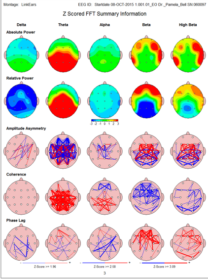 Brain map 1 Epilepsy for Neurofeedback Case Study Dr. Pamela Bell